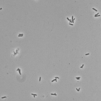 Corynebacterium renale