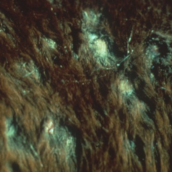 Dermatophilus congolensis
