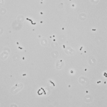Enterococcus faecalis