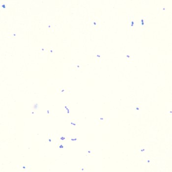 Enterococcus fáecalis