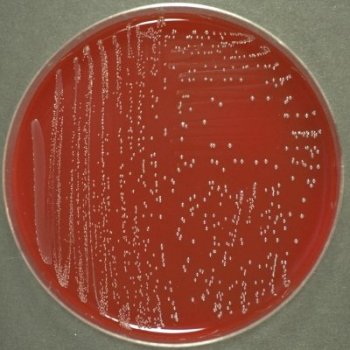 Enterococcus faecalis