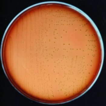 Enterococcus faecalis
