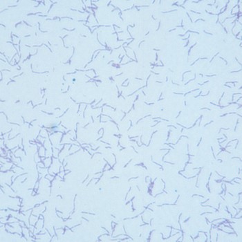Erysipelothrix rhusiopathiae