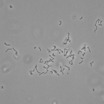 Erysipelothrix rhusiopathiae