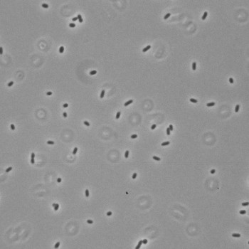 Escherichia coli