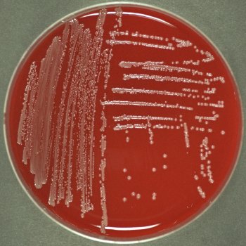 Escherichia coli