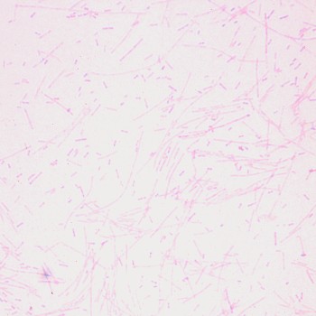Fusobacterium necrophorum A