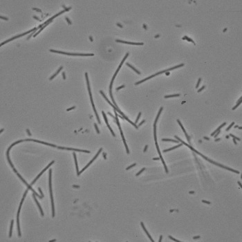 Fusobacterium necrophorum A