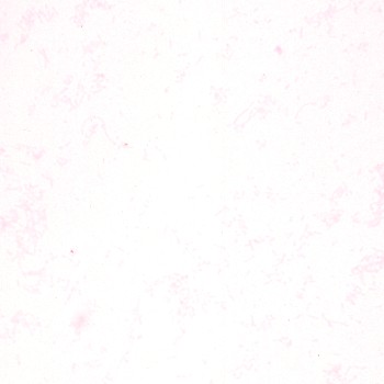 Fusobacterium necrophorum B