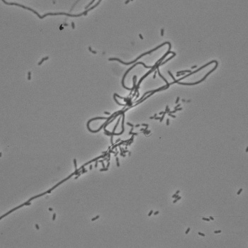 Fusobacterium necrophorum B
