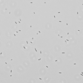 Listeria monocytogenes