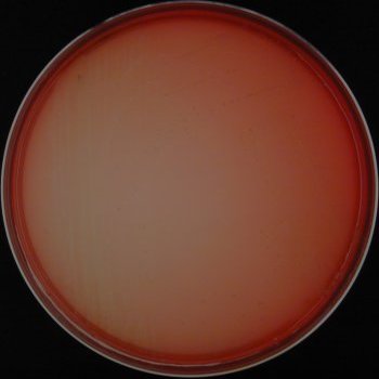 Listeria seeligeri