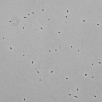 Mannheimia haemolytica