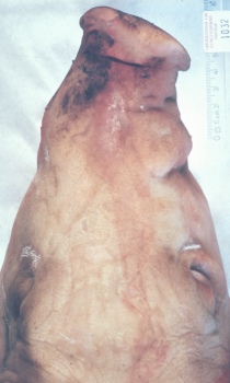 Moraxella bovis