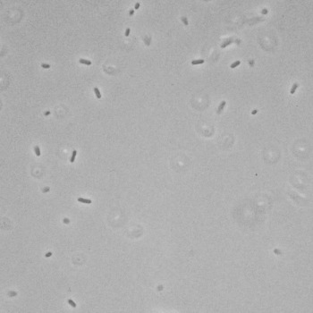 Proteus mirabilis