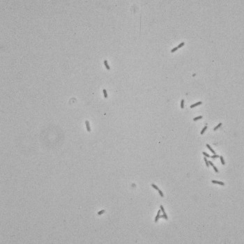 Pseudomonas aeruginosa