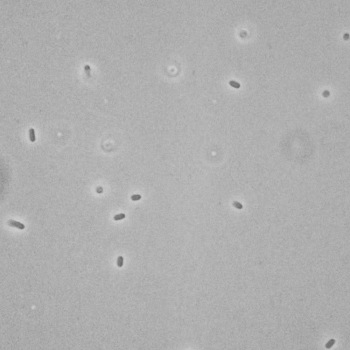 Shigella sonnei