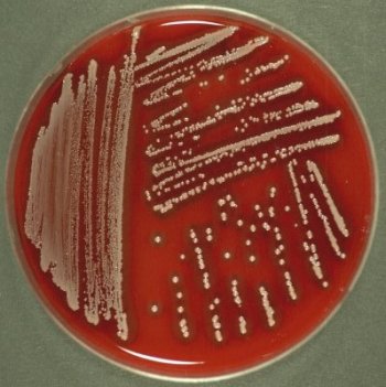 Staphylococcus aureus