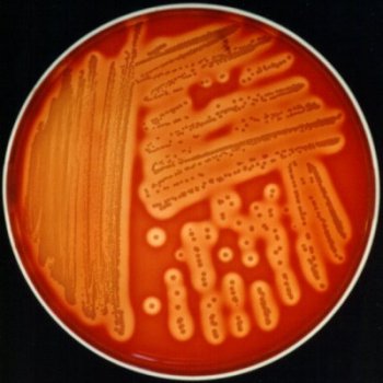 Staphylococcus aureus