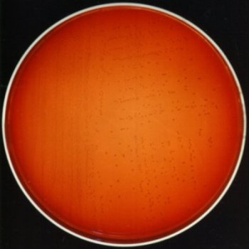 Streptococcus agalactiae