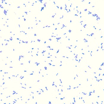 Streptococcus pneumoniae