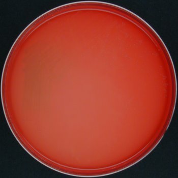 Streptococcus uberis