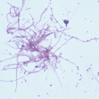 Streptomyces albus