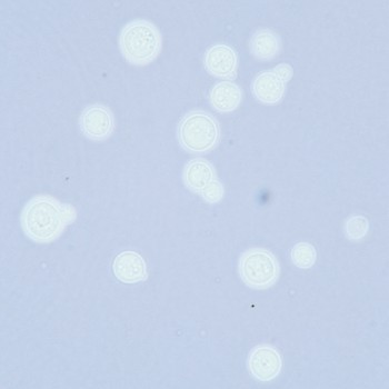 Cryptococcus neoformans