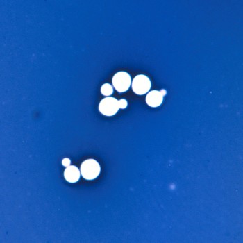 Cryptococcus neoformans