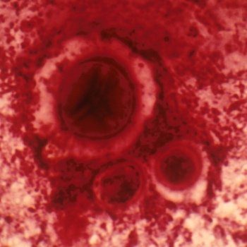 Cryptococcus neoformans