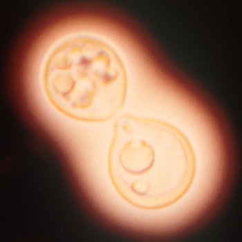 Cryptococcus neoformans