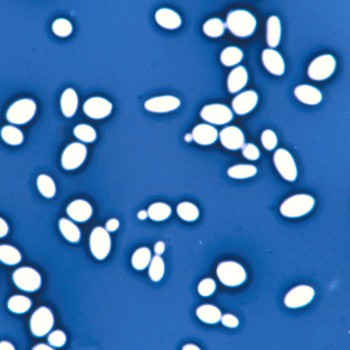 Saccharomyces cerevisiae