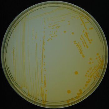 Bromthymol-blue Sucrose Agar
