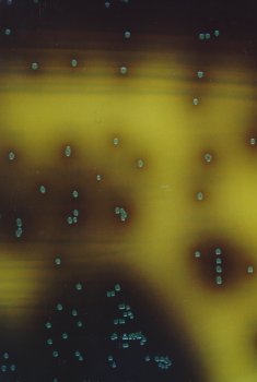 Oxford Agar