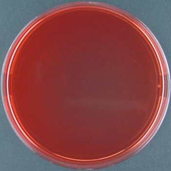Xylose-lysin-desoxycholat-agar